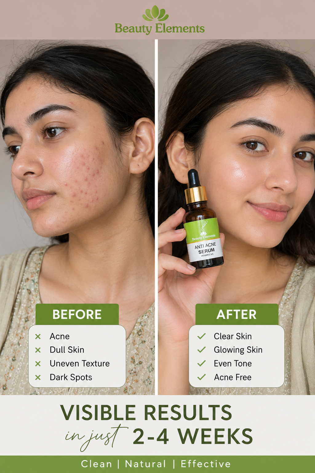 ANTI ACNE SERUM VITAMIN C & E / REMOVE ACNE 100%